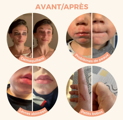Baume magique Neutre 100ml - LES PETITS PRODIGES